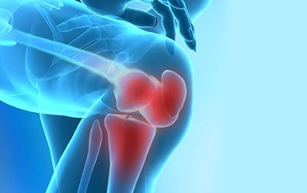 how osteoarthritis of the knee joint manifests itself
