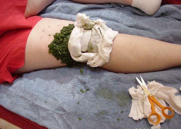 A warm compress of crushed cabbage leaves on a painful knee joint in case of arthrosis